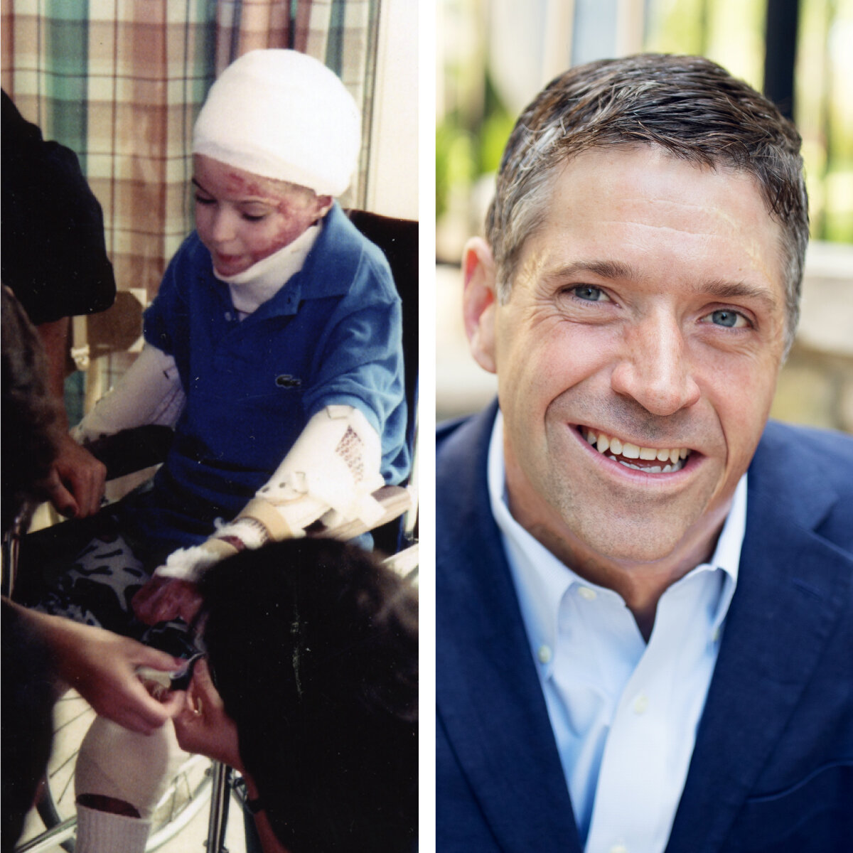 Ep. 3 John O’Leary: From Burn Victim to Author & Awe Evangelist
