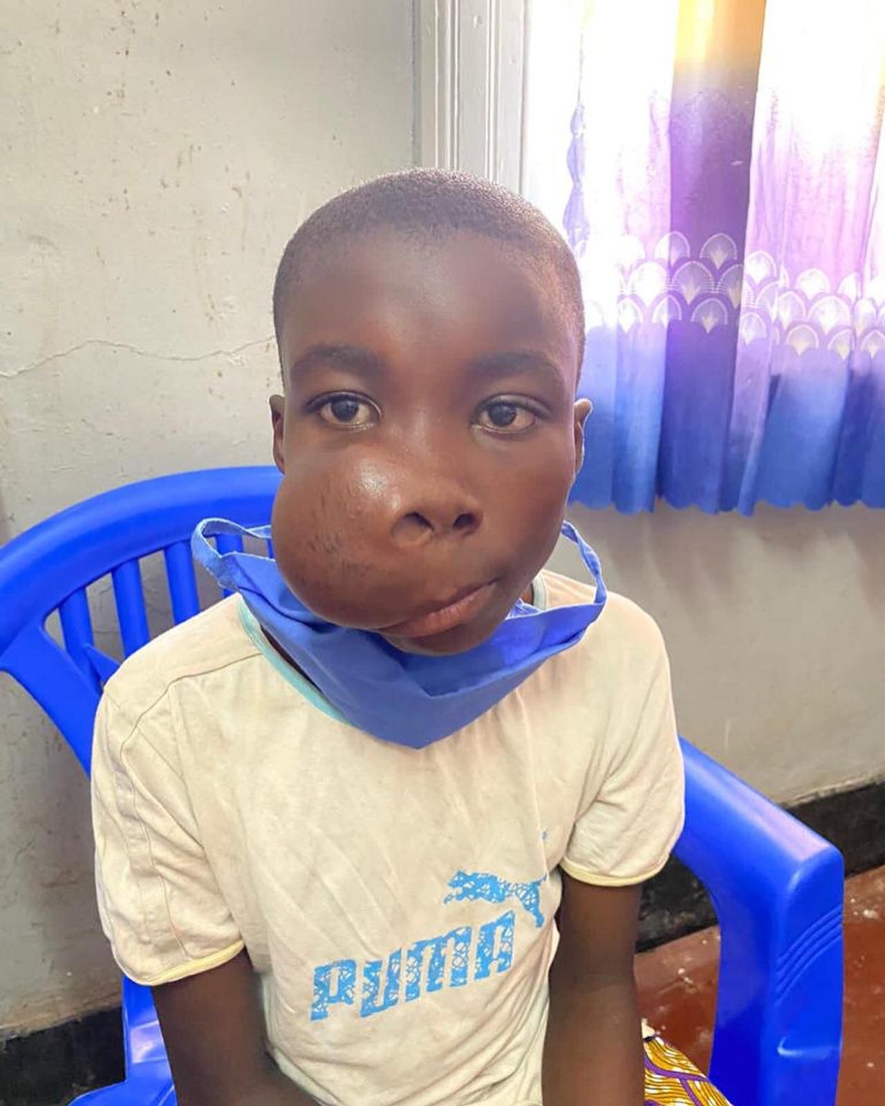 What a difference a year makes! 14 year old, Jeanti, had a large tumor removed in April of 2021. After missing 3 years of school he is now back on track excelling in 6th grade, playing soccer with his friends, and flashing that million watt smile 24/