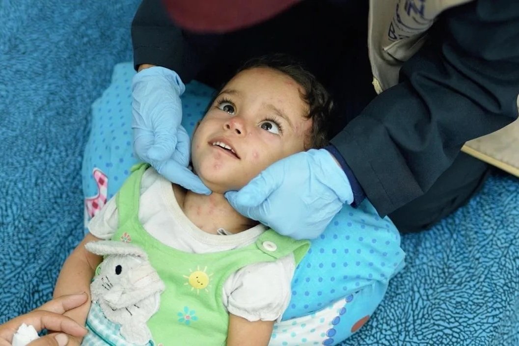 Disability support in Gaza as impact of war still a daily reality