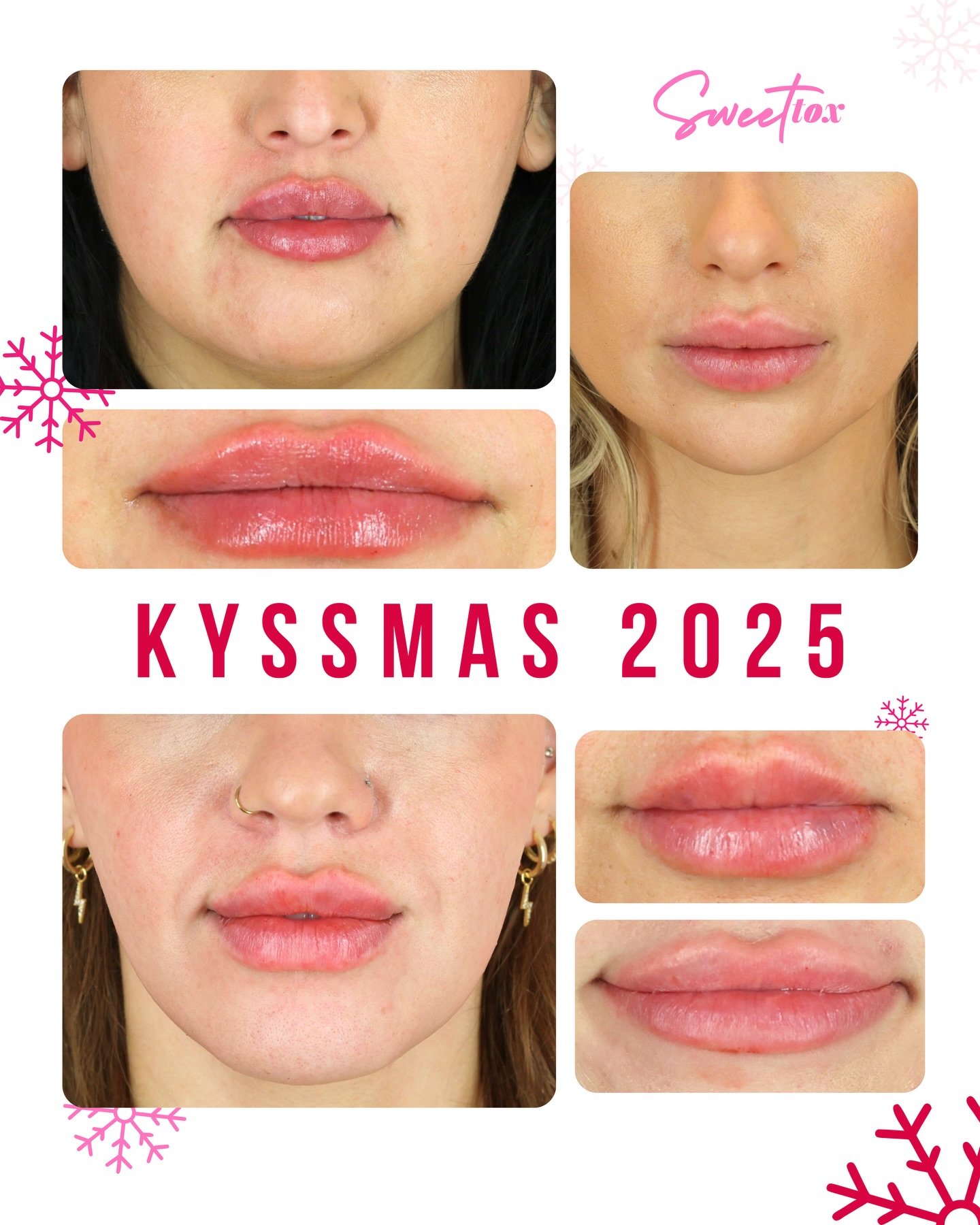 🎄 MERRY 💋 KYSSMAS 💉 2025

With over 80 of you joining in on the Kyssmas fun today, here&rsquo;s a snippet of just some of the cutie lippies we sleighed! We had SO so so so much fun with you all, and hope you&rsquo;re remembering to ice those babie