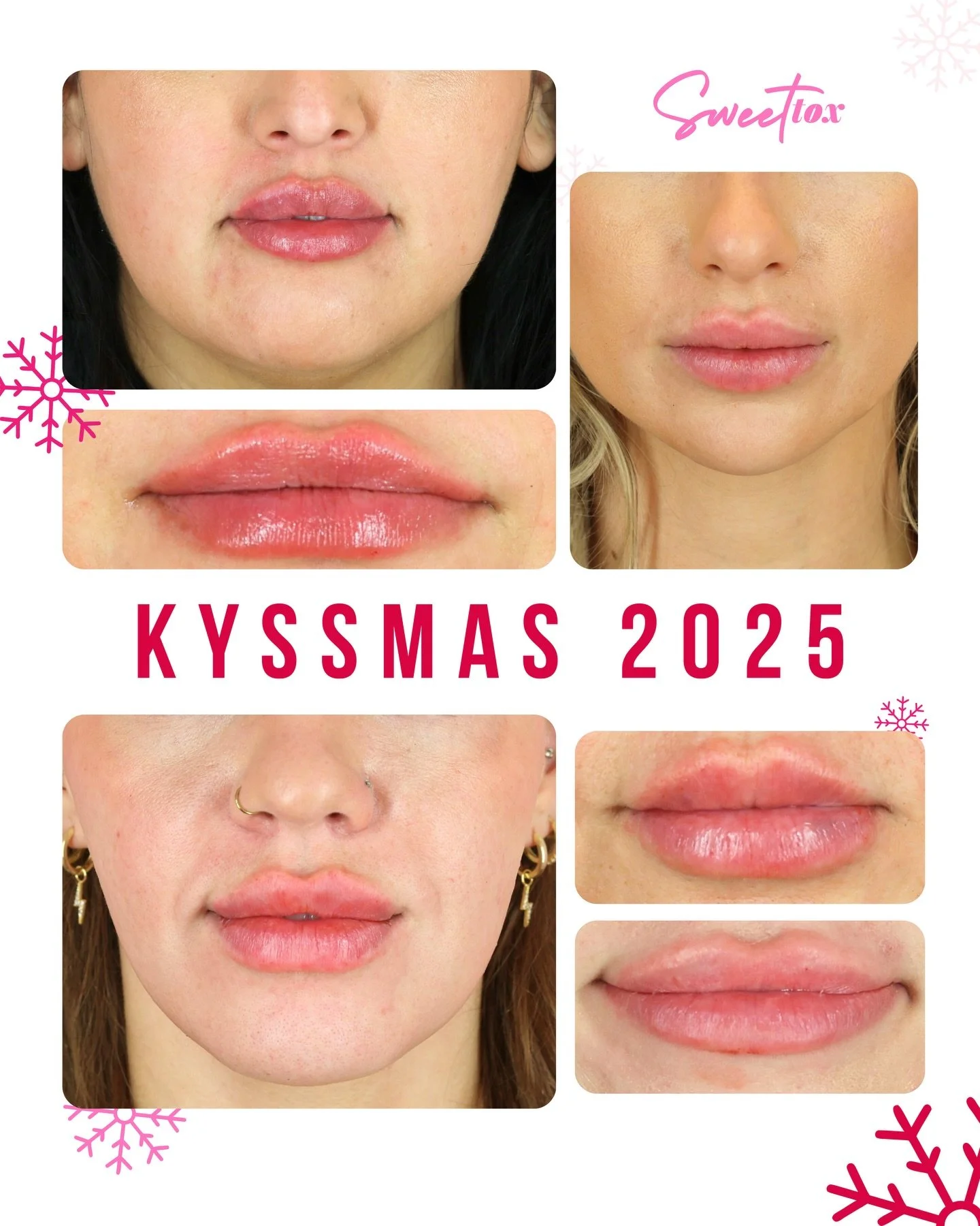 🎄 MERRY 💋 KYSSMAS 💉 2025

With over 80 of you joining in on the Kyssmas fun today, here&rsquo;s a snippet of just some of the cutie lippies we sleighed! We had SO so so so much fun with you all, and hope you&rsquo;re remembering to ice those babie