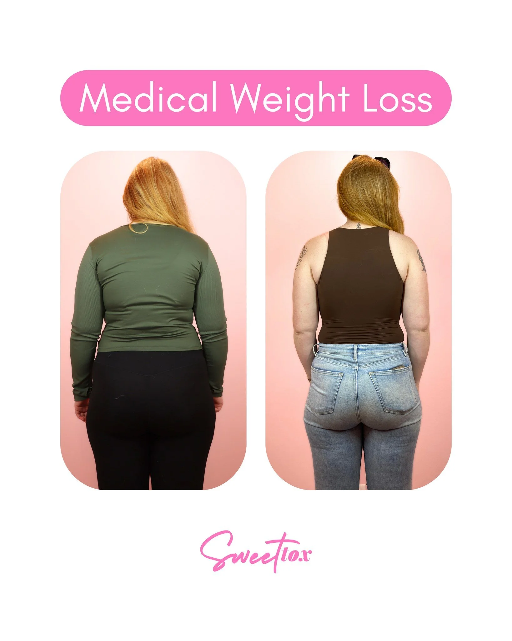 Throwback to one of our favorite #medicalweightloss before &amp; afters 💪

This gal was one of the first to trust Angie with her weight loss goals, and she hasn't looked back since! With the tools Angie provided her, she's been killing it in the gym