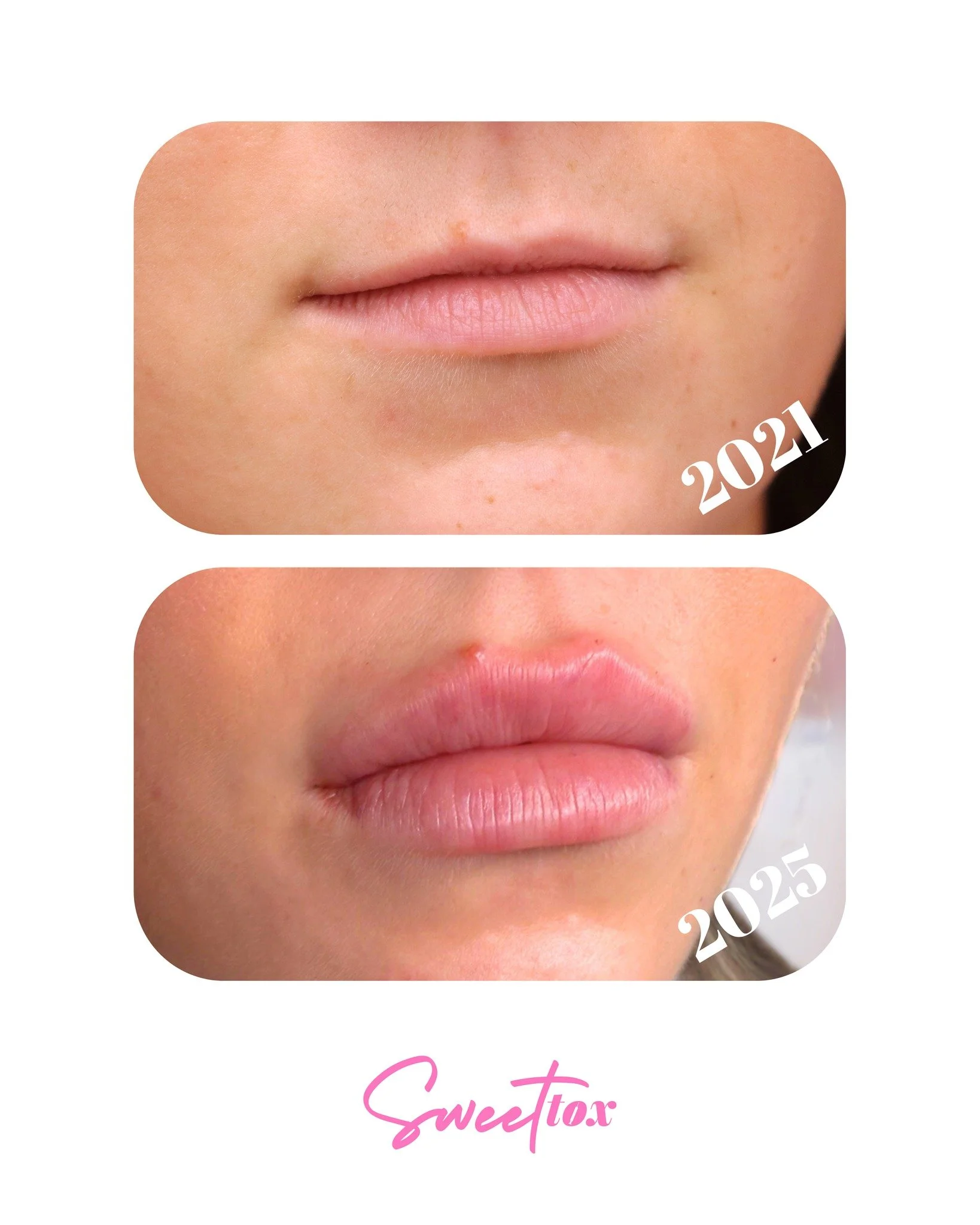 HIIII EVERYONE! Maddie (Operations Manager) here 👋

I wanted to talk about my lippie journey for a hot sec, because ohhhh baby, a journey it has BEEN. 

Throughout the almost 5 years that I've been with Sweet Tox, I knew from the get-go that it woul