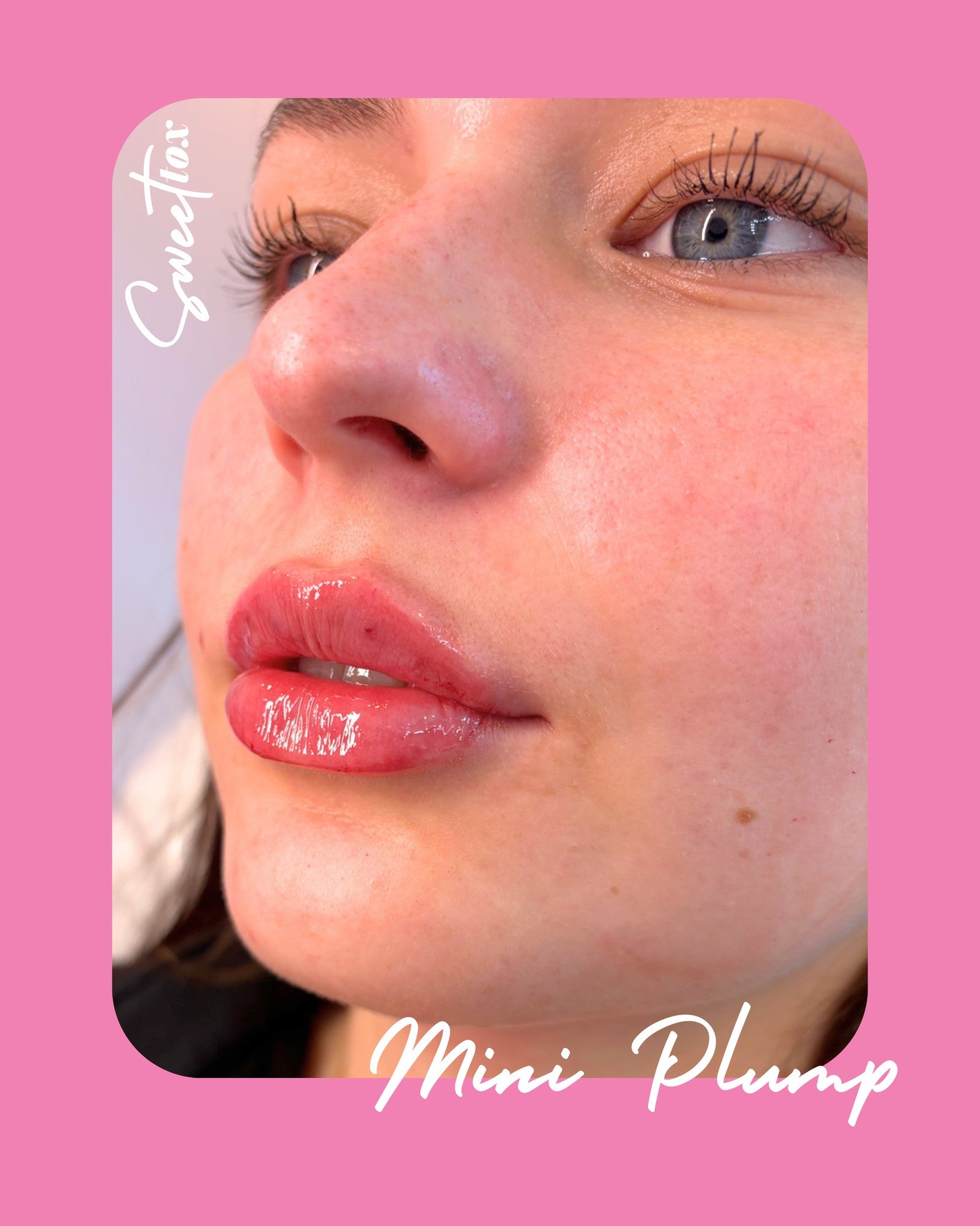 MINI PLUMP ✨💋

A Mini Plump (aka a half syringe) is the sweet spot for subtle, intentional enhancement. Typically perfect for maintaining your current shape, refreshing volume over time, or easing into lip filler for the first time 👄

This beauty c