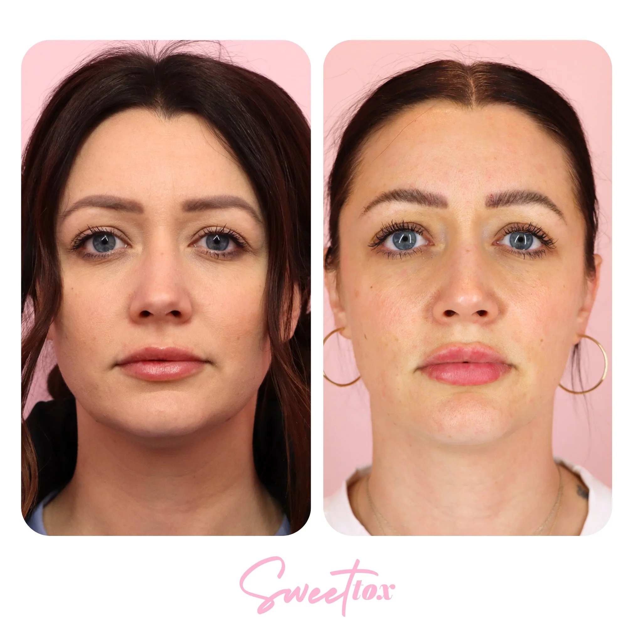 PDO Threads — Sweet Tox