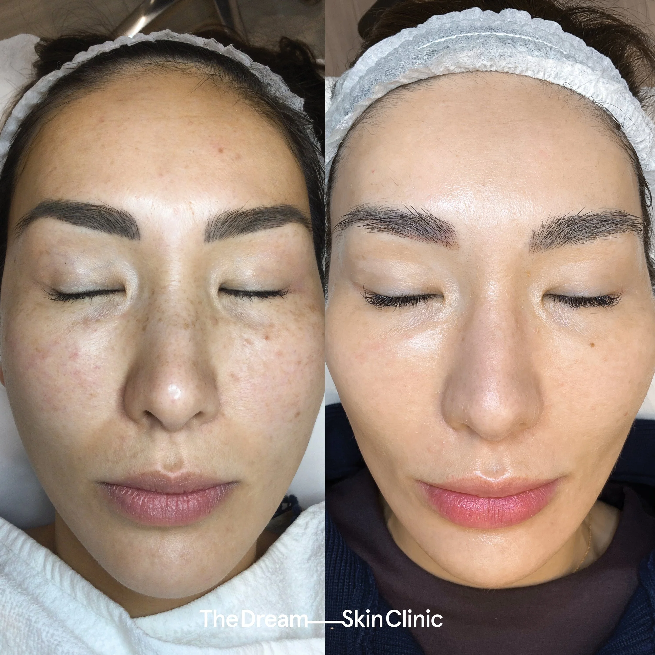 Susie, G (Front)..jpg