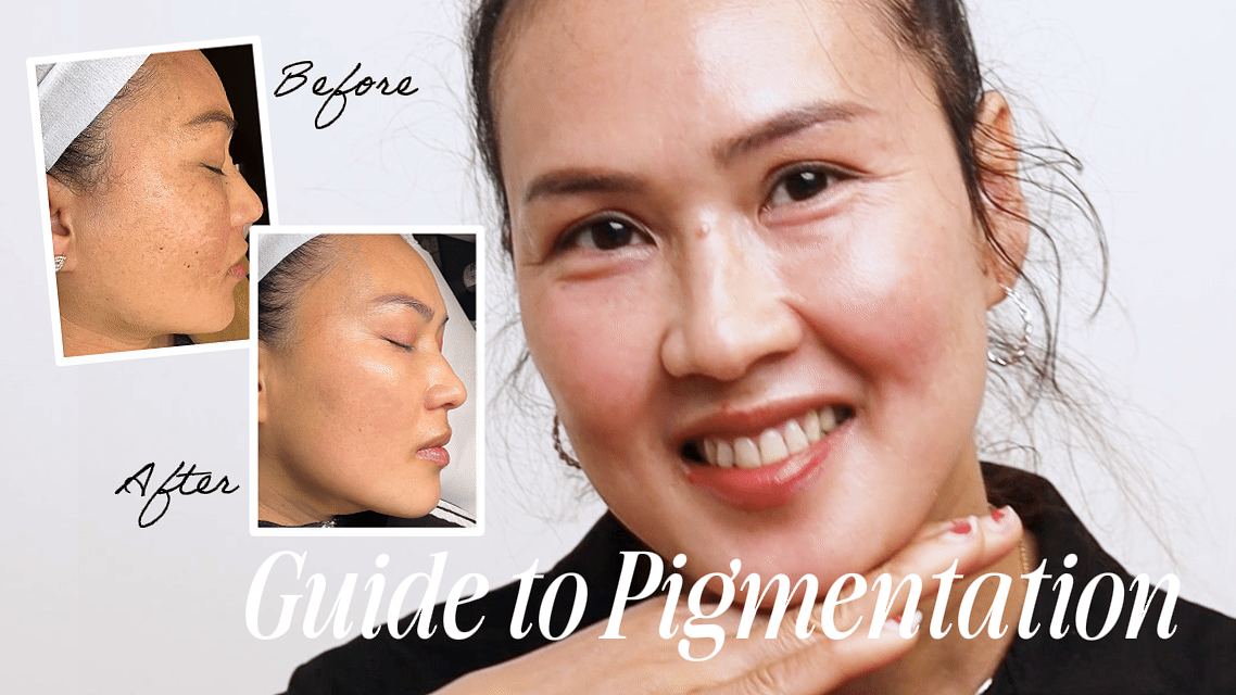 All About Pigmentation: What It Is, Types, and How to Manage It 