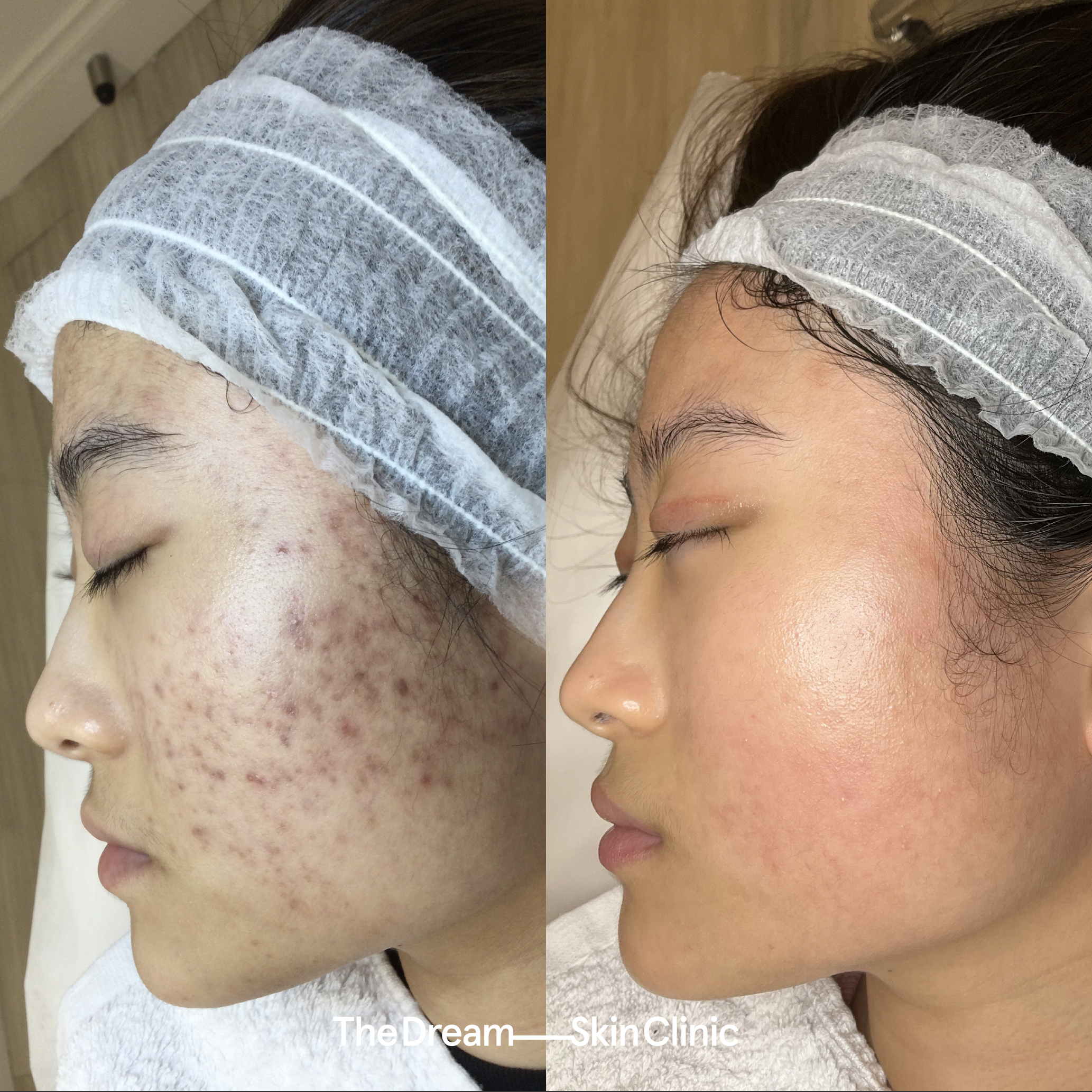 Clarissa (Left)..jpg