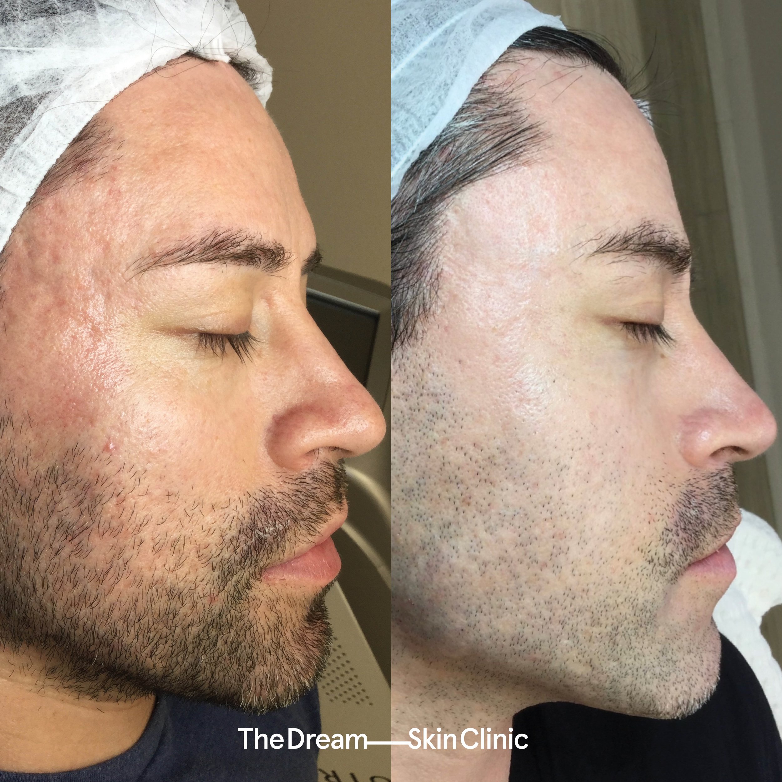 Daniel, H (Right)..jpg