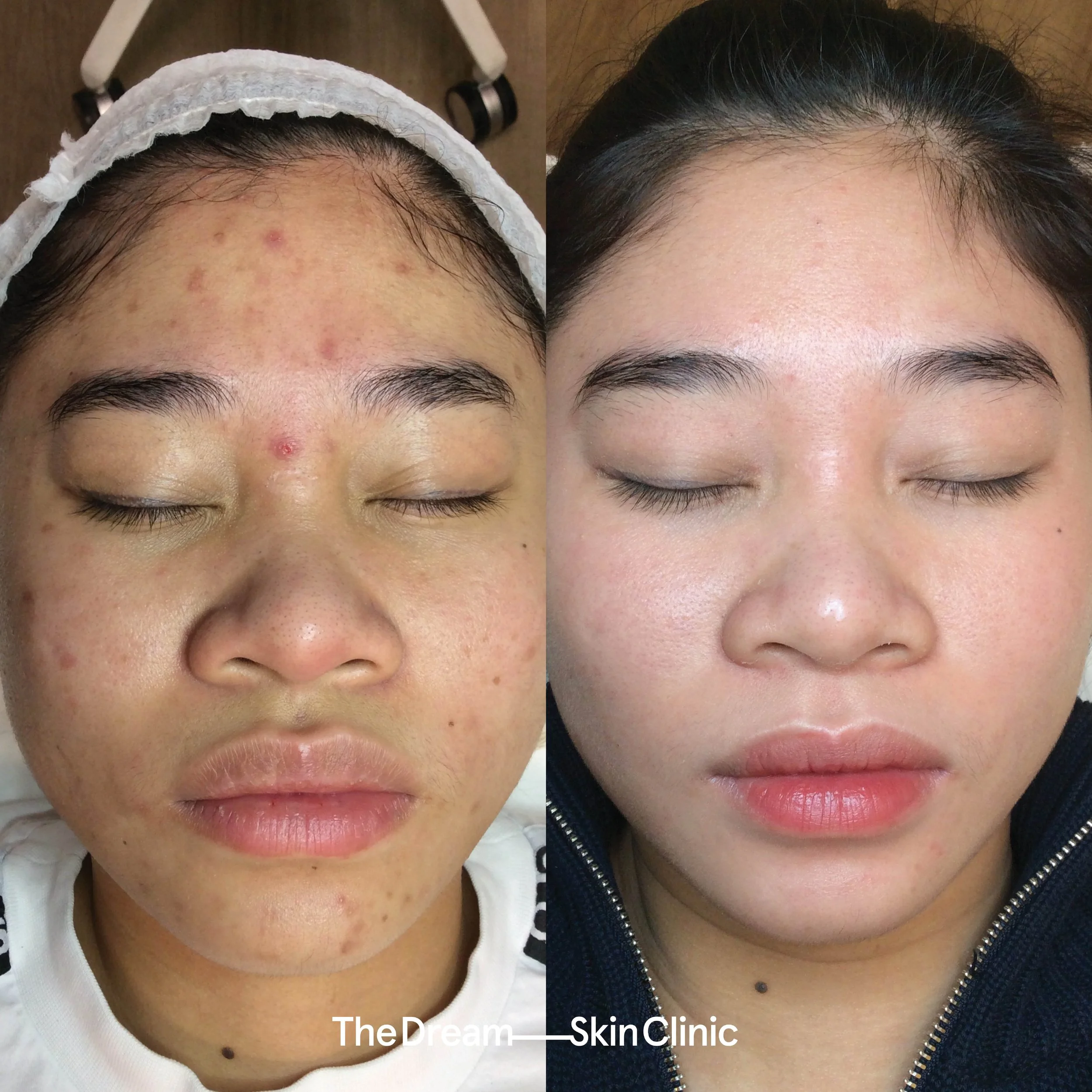 Trang D (Front)..jpg