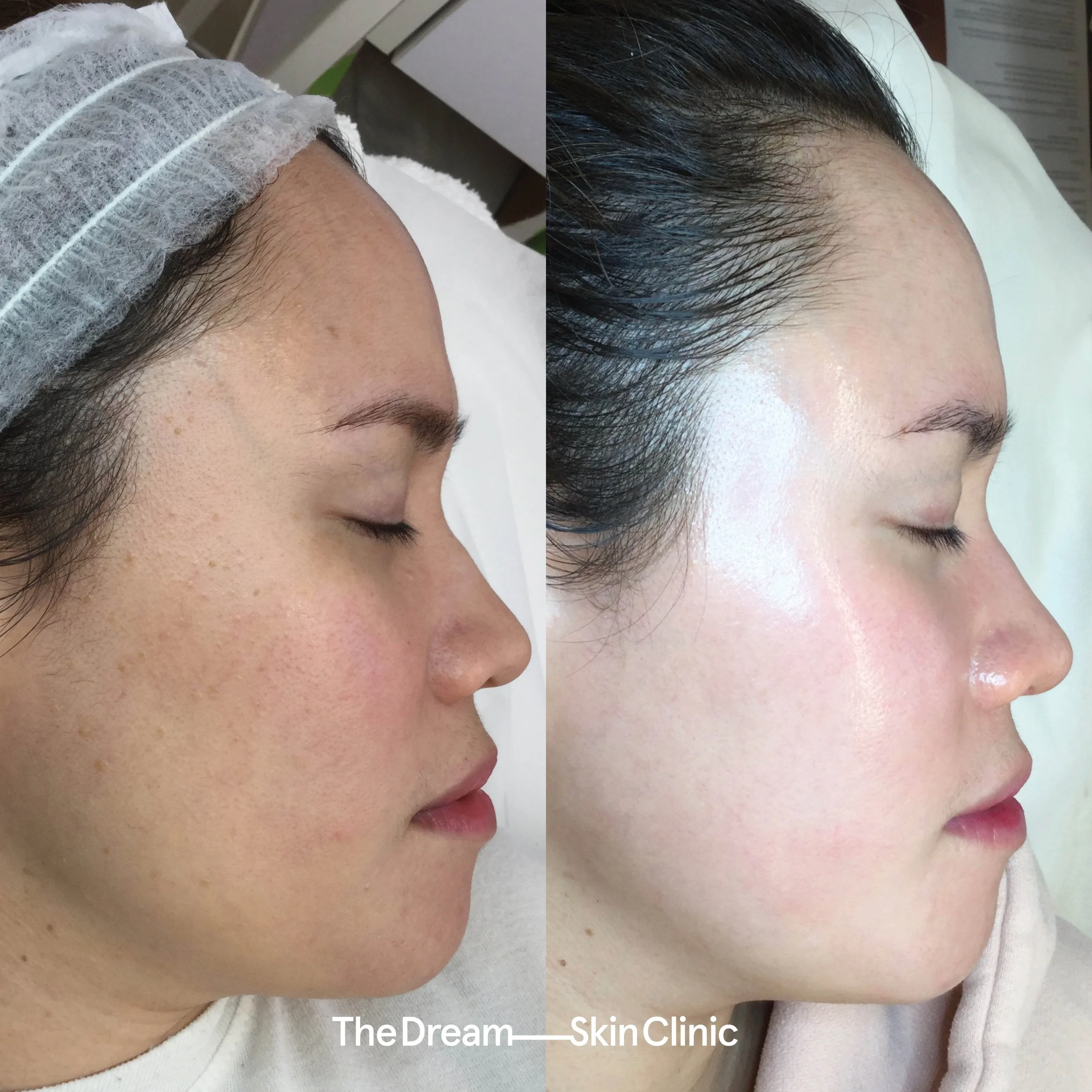 Khrisna, O (Right)..jpg