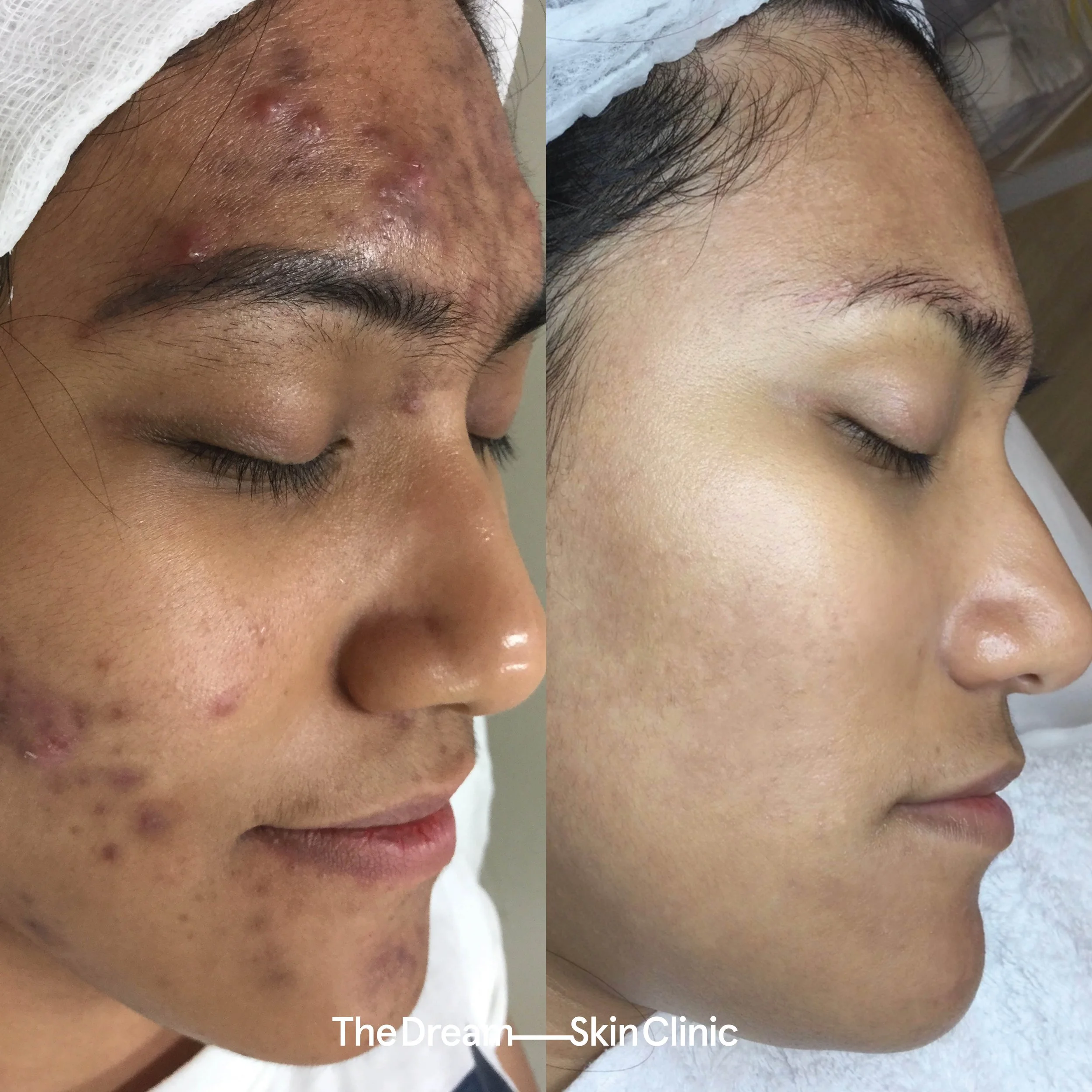 Catherine (Right)..jpg