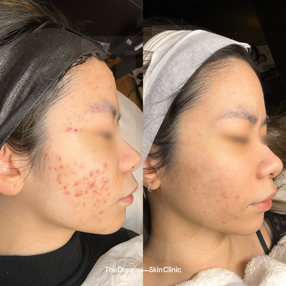 NICOLE TAN_RIGHT.png