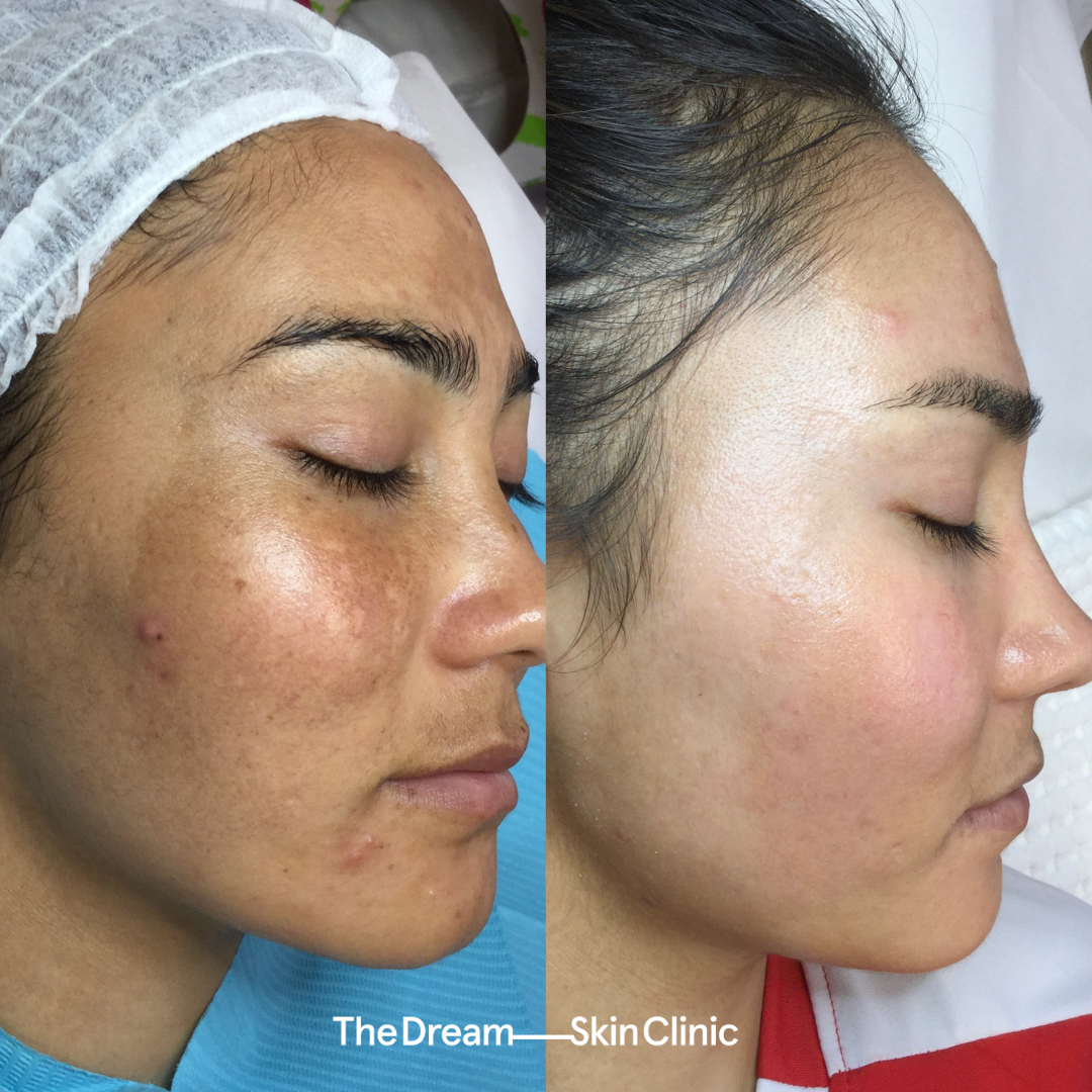 Sita, K (Right)..png