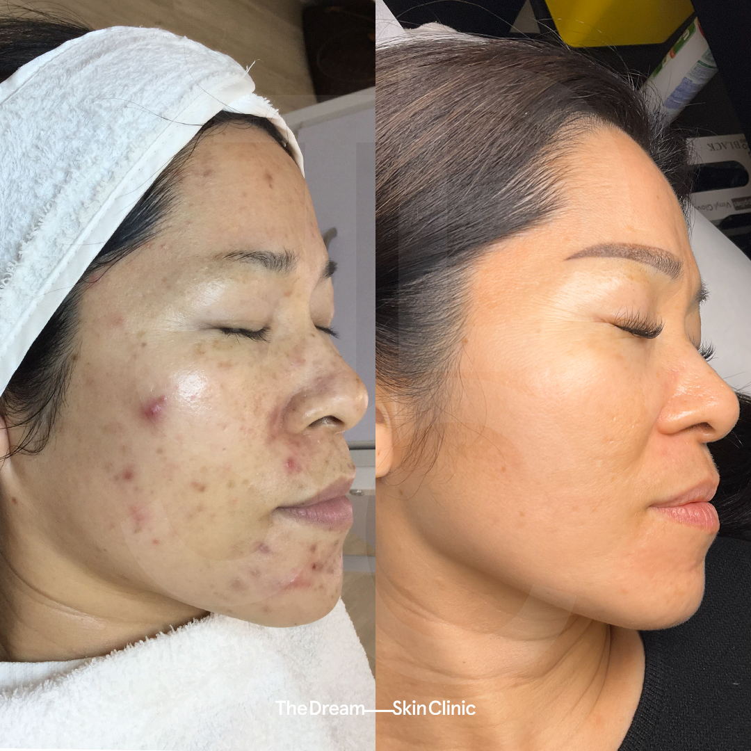 TIFFANY TAING_RIGHT.png