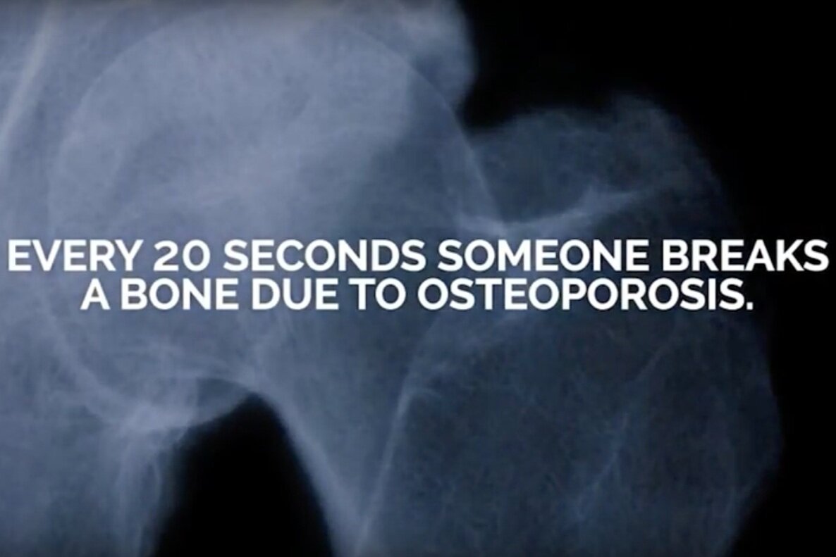 Osteoporosis awareness