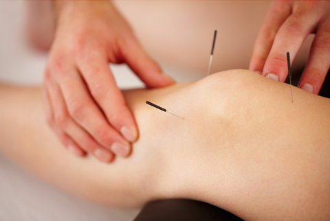 Relieve Back Pain with Acupuncture in Midtown Kansas City