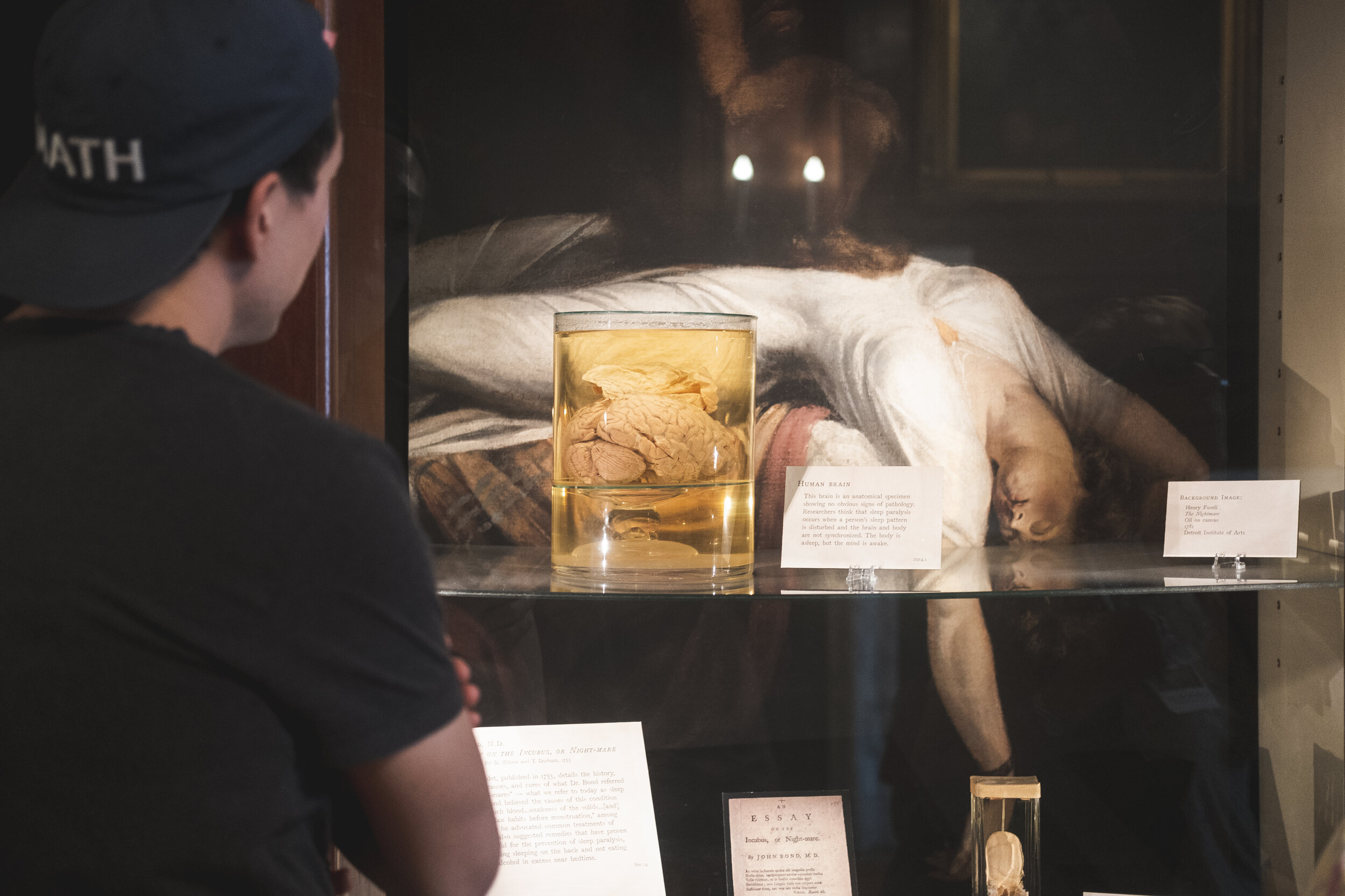 2019_MUTTER MUSEUM_MUSEUM_THE PHILLY CHECKLIST-3.jpg