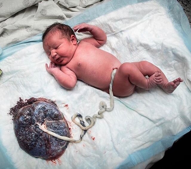 Placenta&rsquo;s are a life source. 💚 Often referred to as the &ldquo;tree of life,&rdquo; they grow and sustain your baby until they&rsquo;re ready to be born by providing oxygen &amp; nutrients while removing carbon dioxide and other waste product