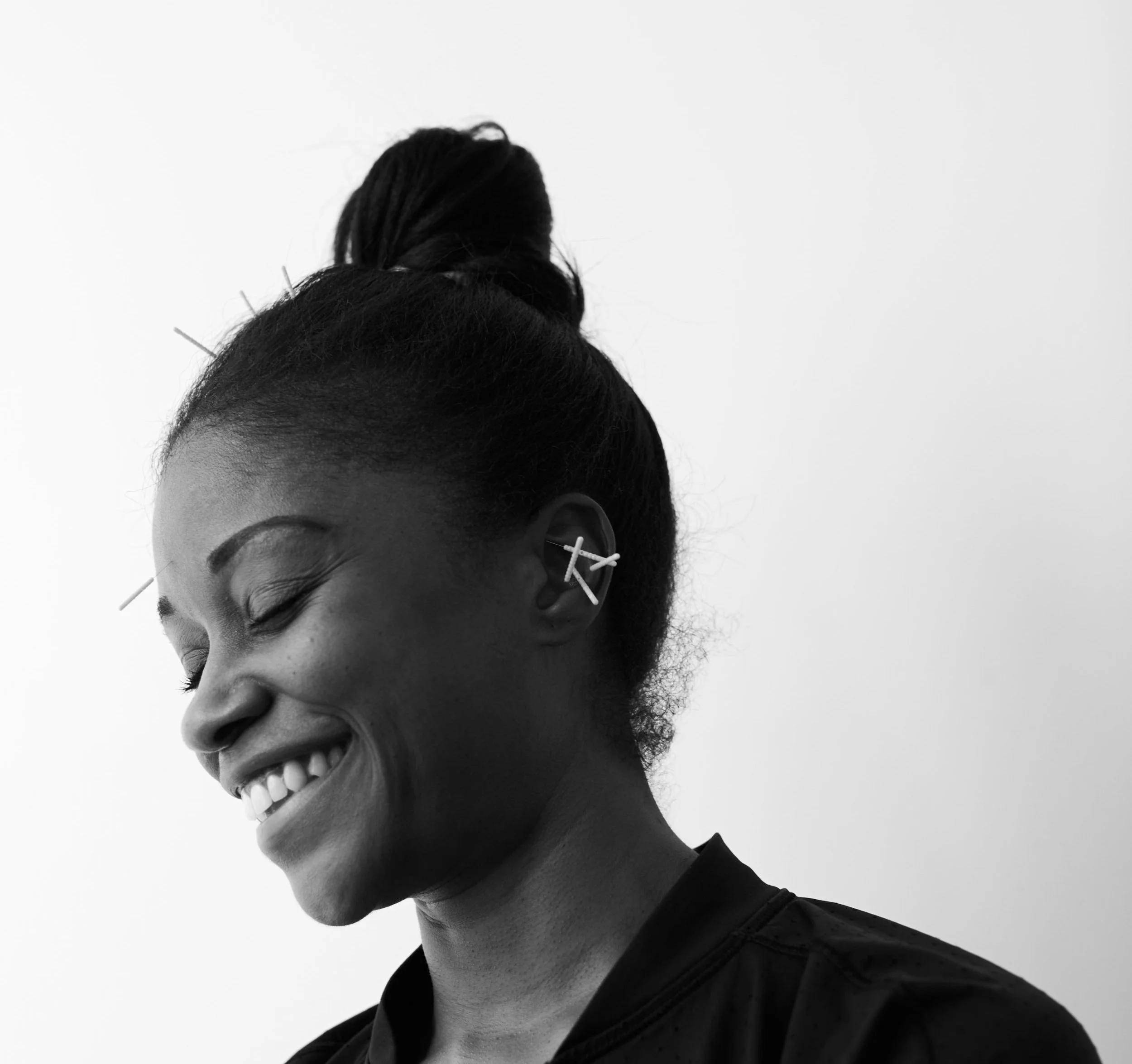 A Transformational First Experience with Taochemy’s 5-Point Ear Acupuncture