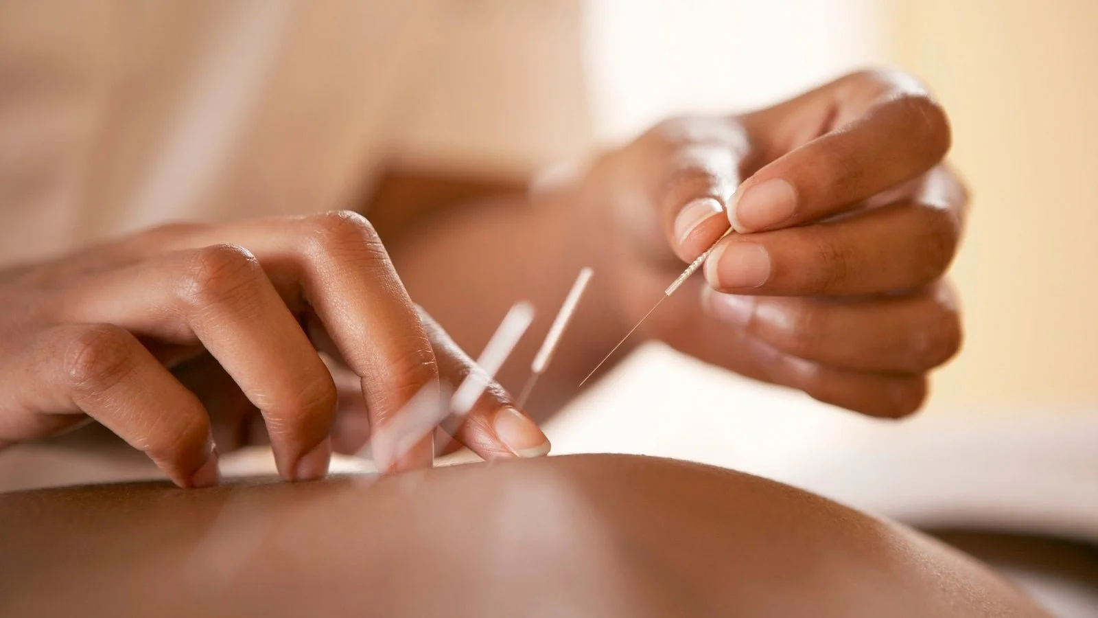 What Your Acupuncturist Wishes You Knew
