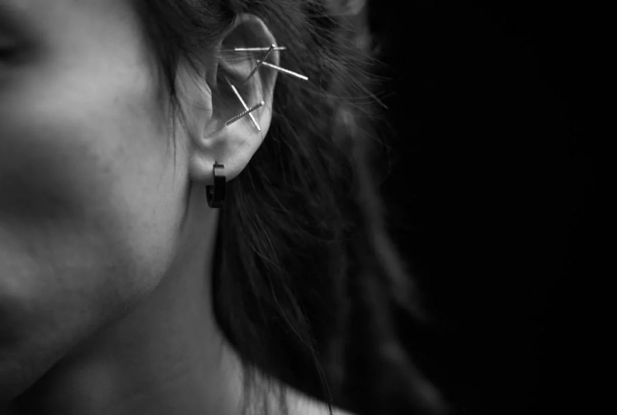 Acupuncture for Detoxification