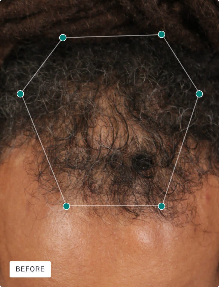 Nutrafol Men6.jpg
