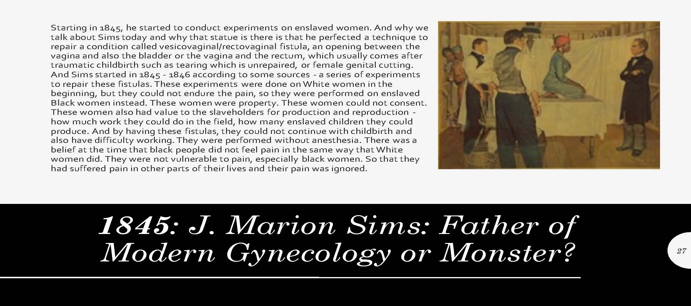 1845 J. Marion Sims.jpg