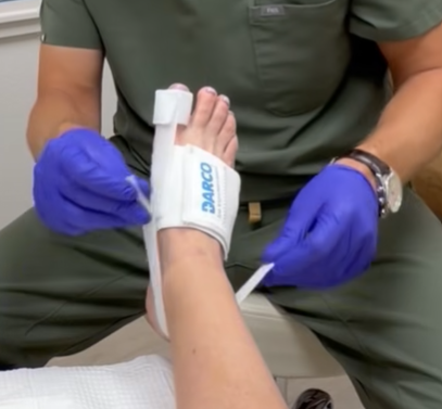 Do Bunion Correctors and Toe Spacers Actually Work?  The 3D Bunion Doc discusses how they can help and not help your bunion(s)