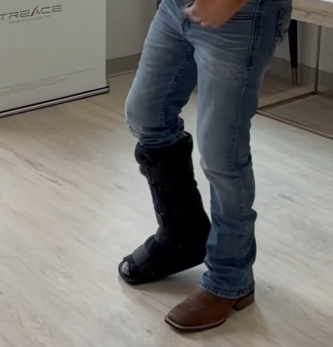 How soon can I walk after bunion correction? Can I walk the same day?  Dr. Steinke instructions for his post-operative patients in Southlake Texas.  