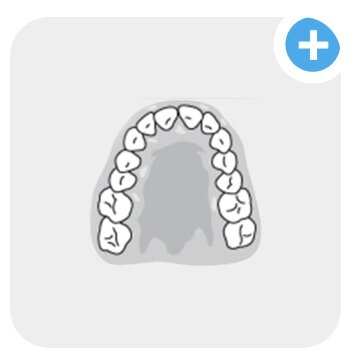 Top teeth template, chewing surfaces