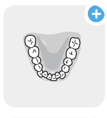 Bottom teeth template, chewing surfaces