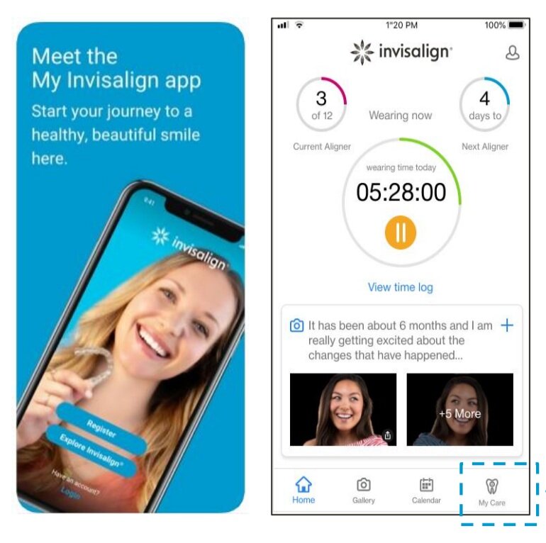 Invisalign+Virtual+Care+Sunset+Dentistry.jpg