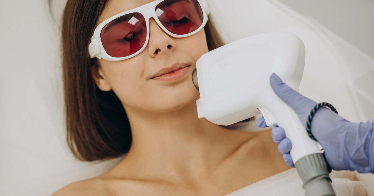 IPL Photofacial — everything you need to know.