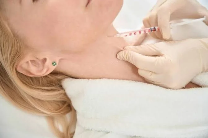 Kybella Fort Lauderdale: How This Treatment Helps Reduce a Double Chin
