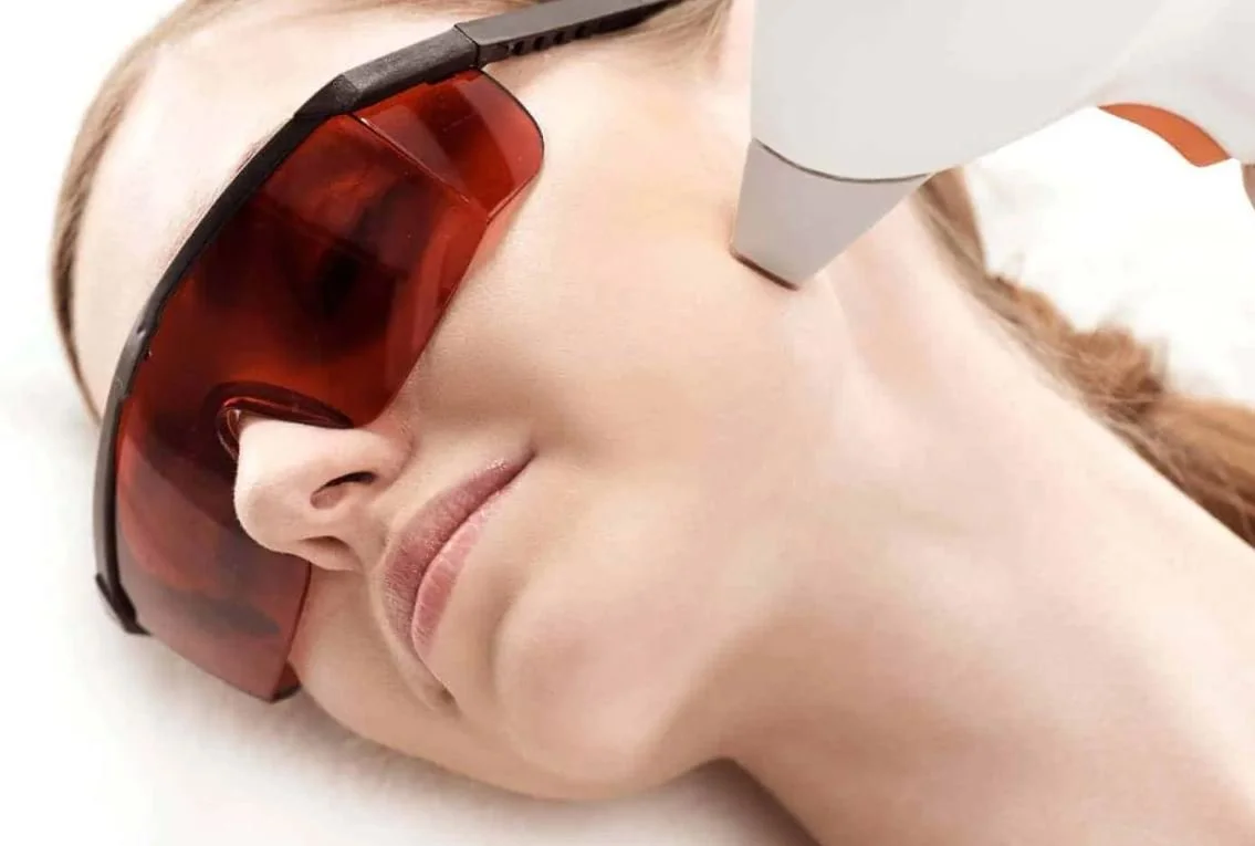 What Can a Photo Laser Facial Do for Sun Damage, Uneven Tone, and Aging Skin?