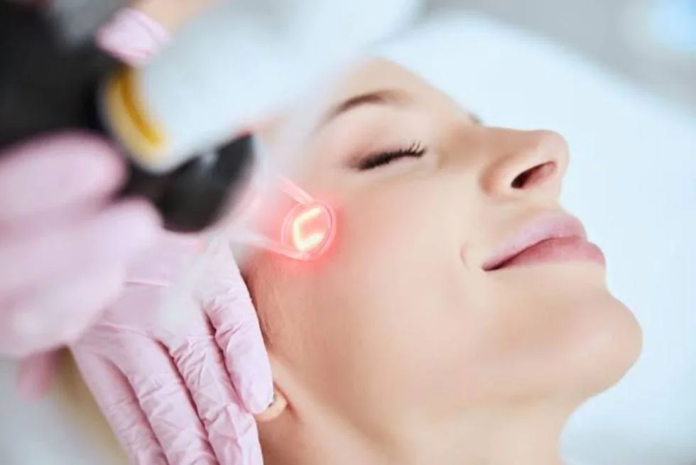 Laser Facial Treatment in Fort Lauderdale