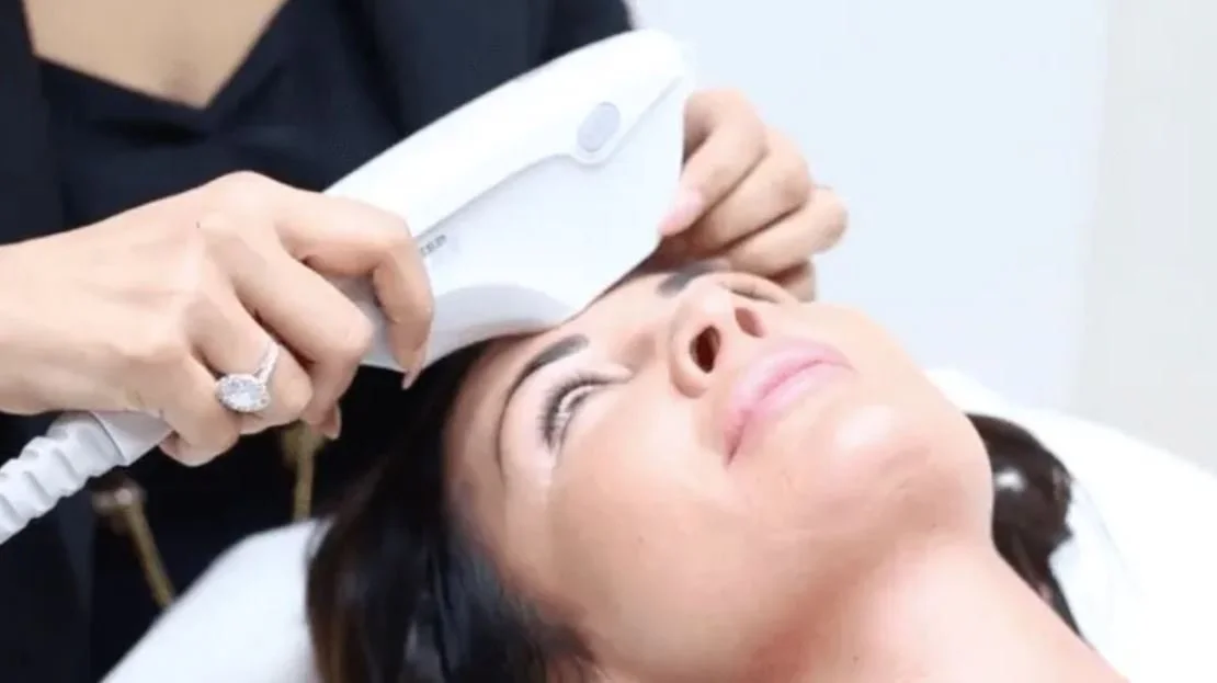Ultherapy Near Me in Naples