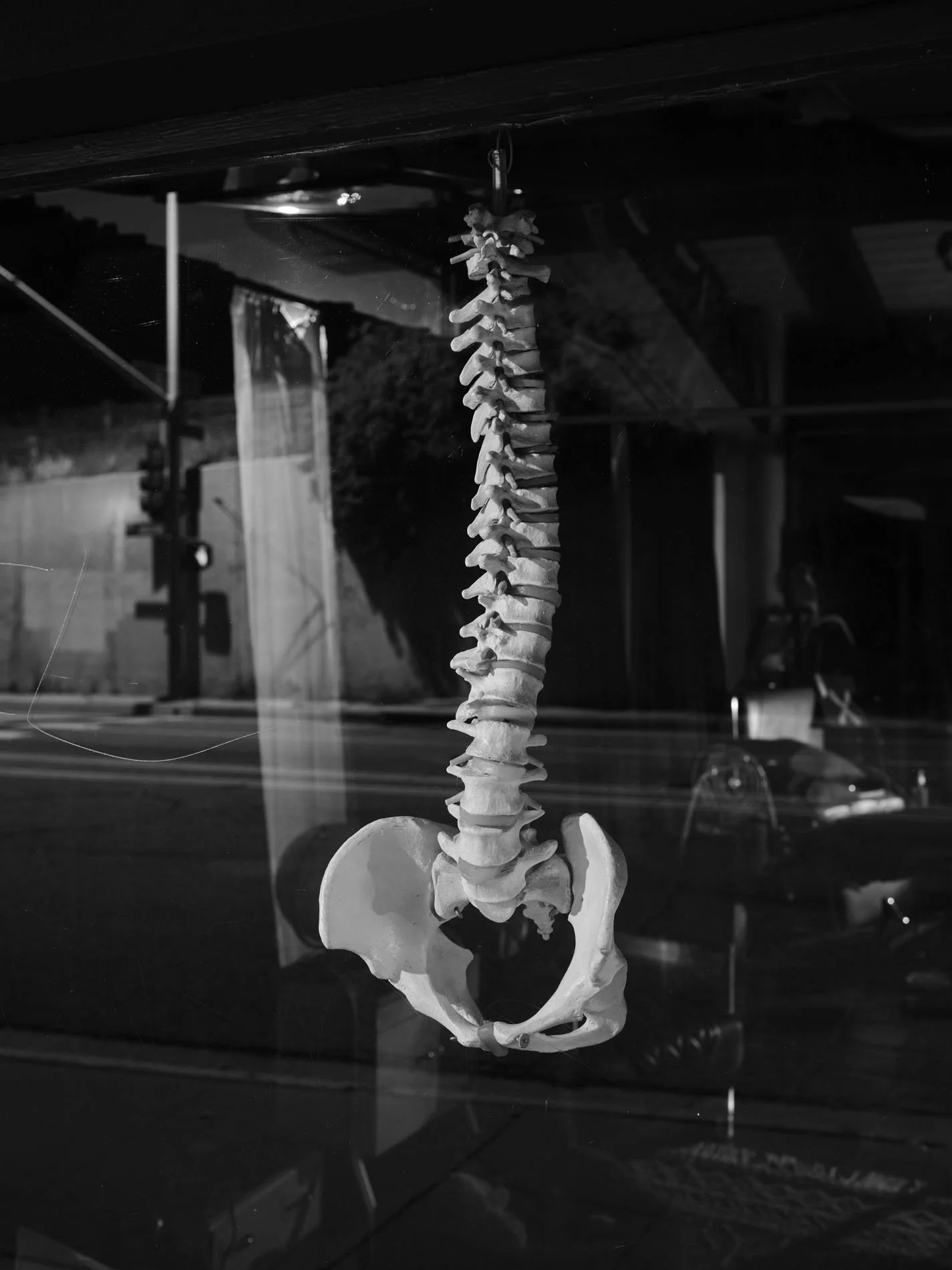 Spine, Pasadena, CA - 2025