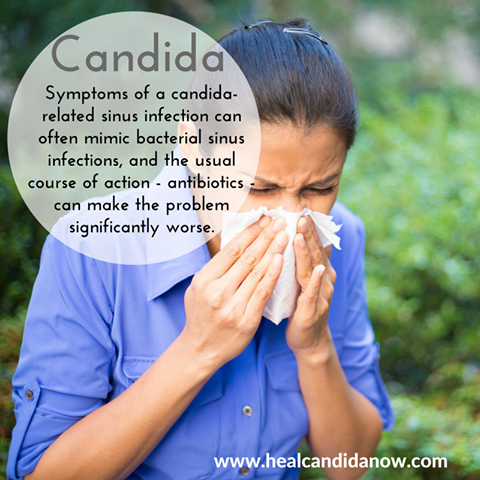 Candida and Sinus Infections