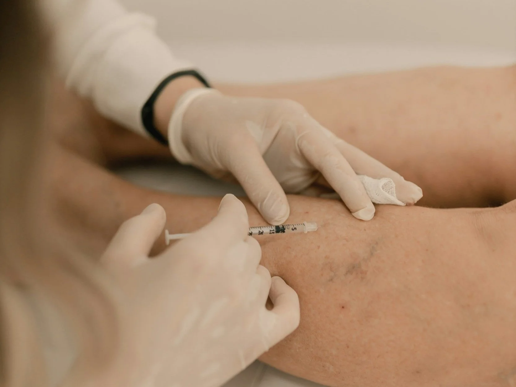 Why We Use Micronized Diosmin and Hesperidin for Vein Treatment