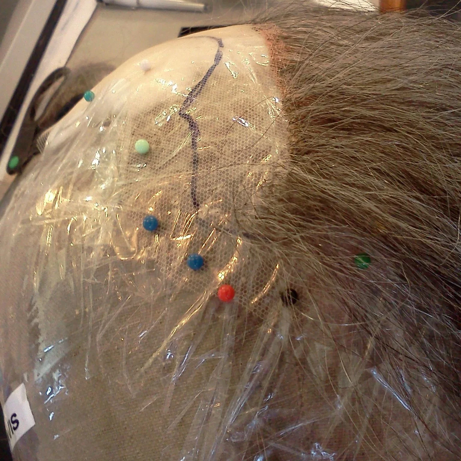 Ventilated hairline for an opera singer at The Santa Fe Opera