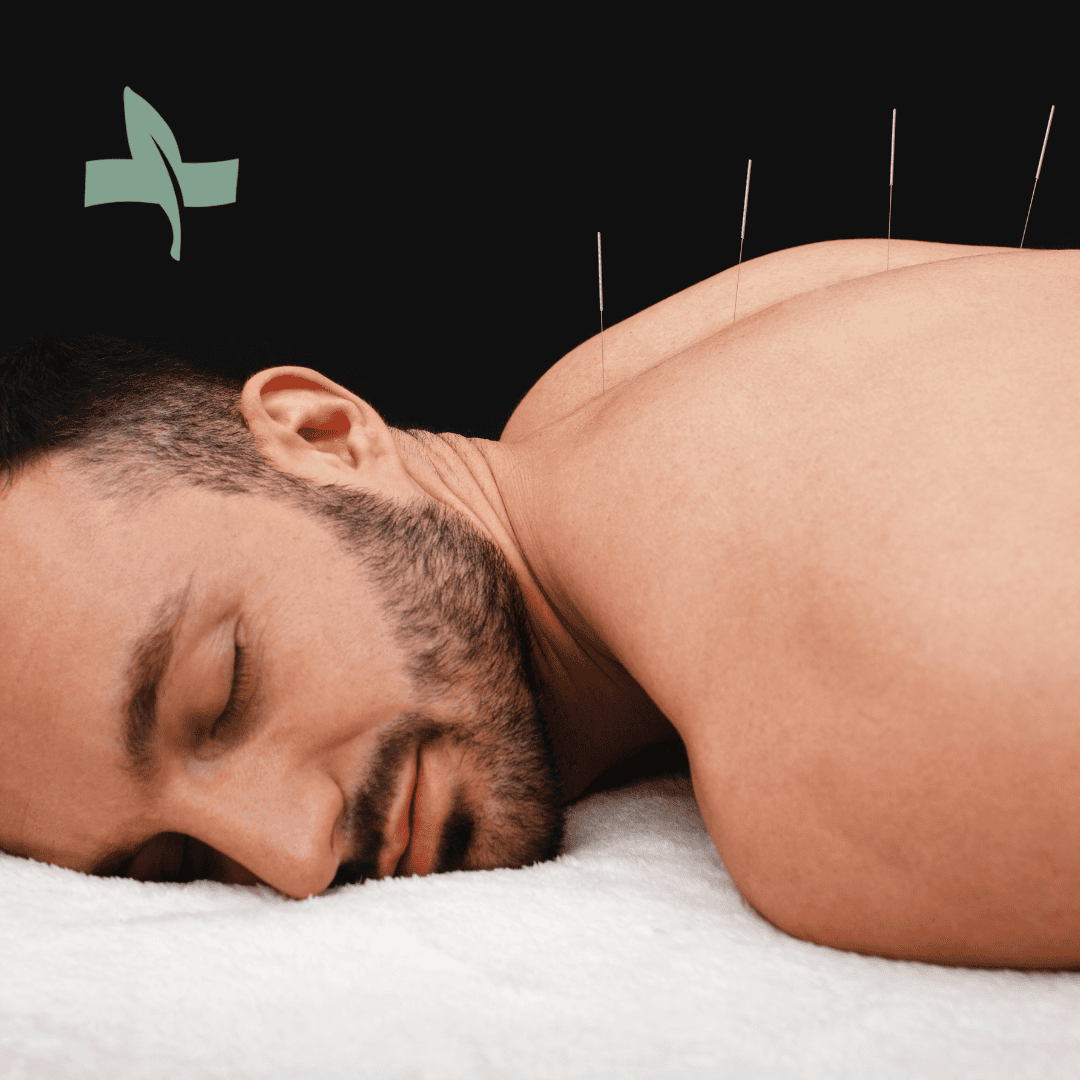 Relaxing acupuncture therapy promoting energy flow and wellness at SageMED.