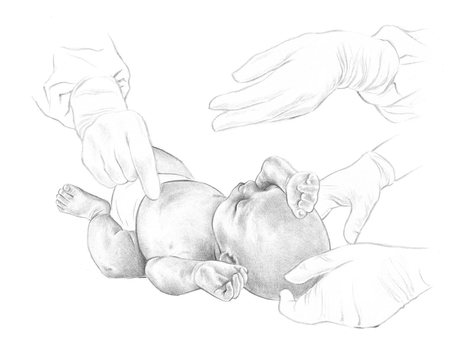 thecut_higtb_surgery (1).jpg