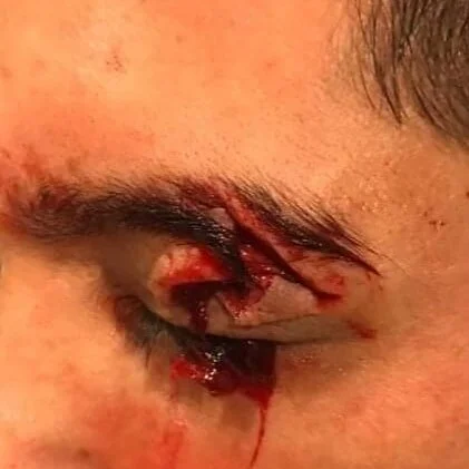 Identificado hombre que apuñaló en el ojo a vigilante privado del Metro