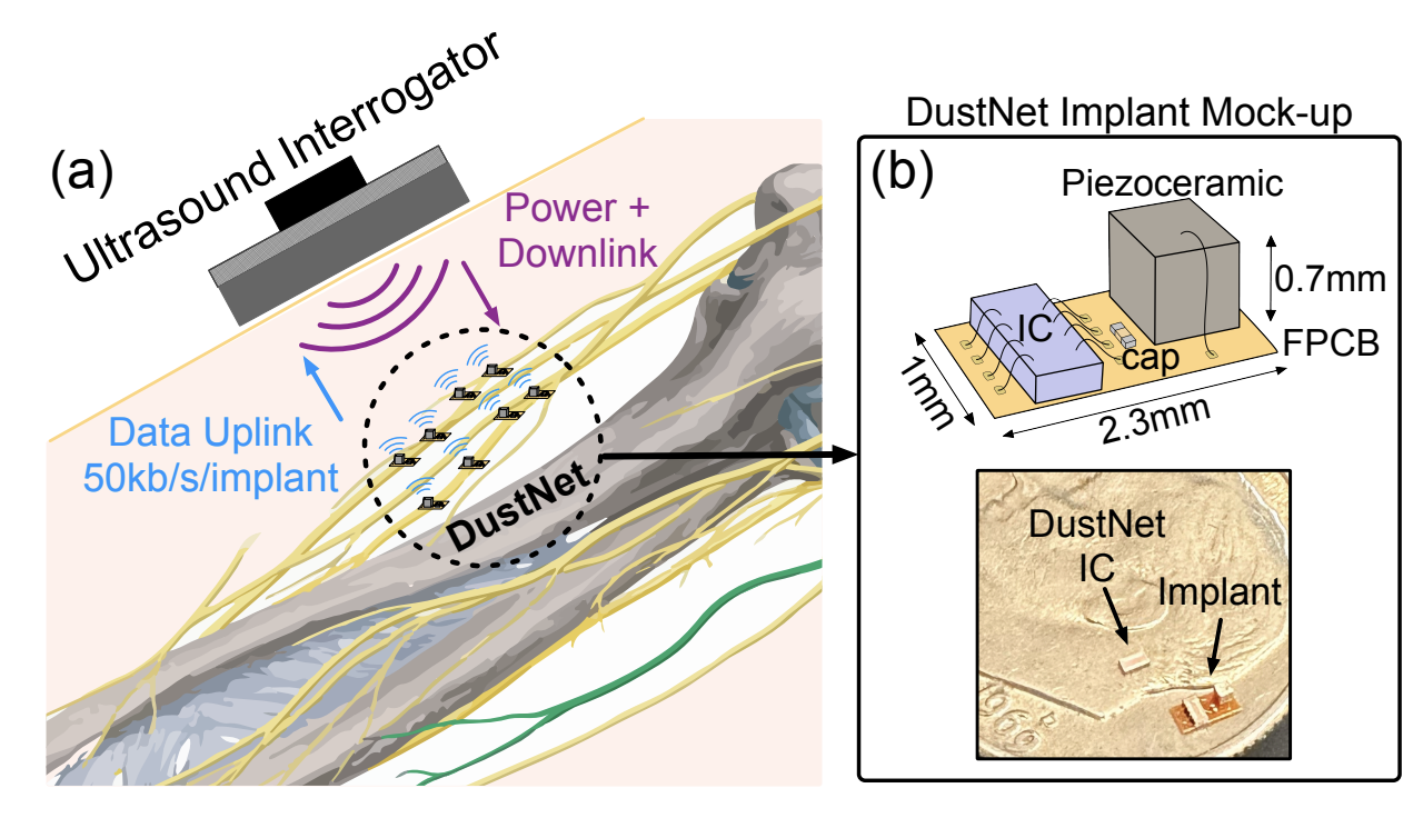 DusNet paper published in TBioCAS