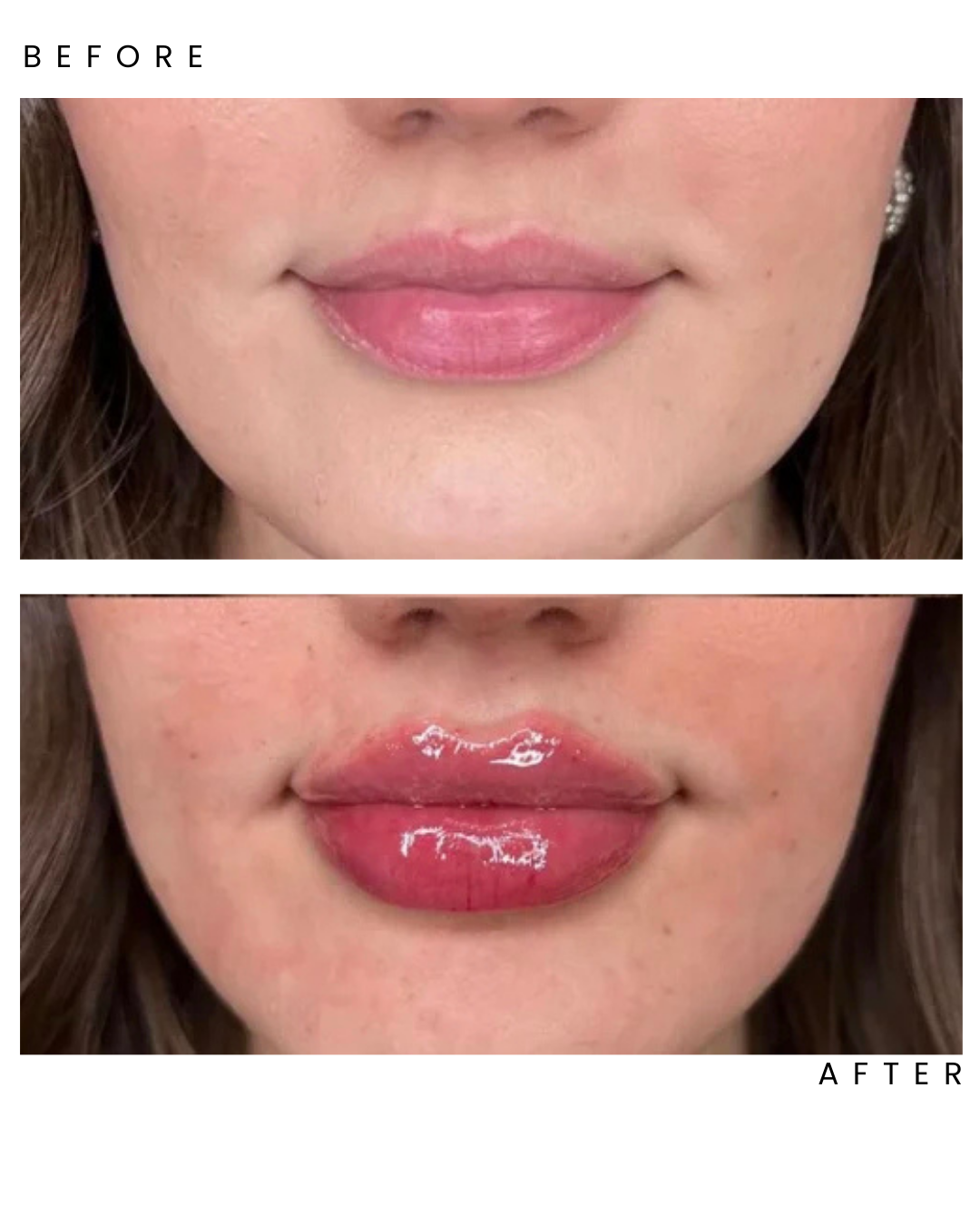 Fillers6.png