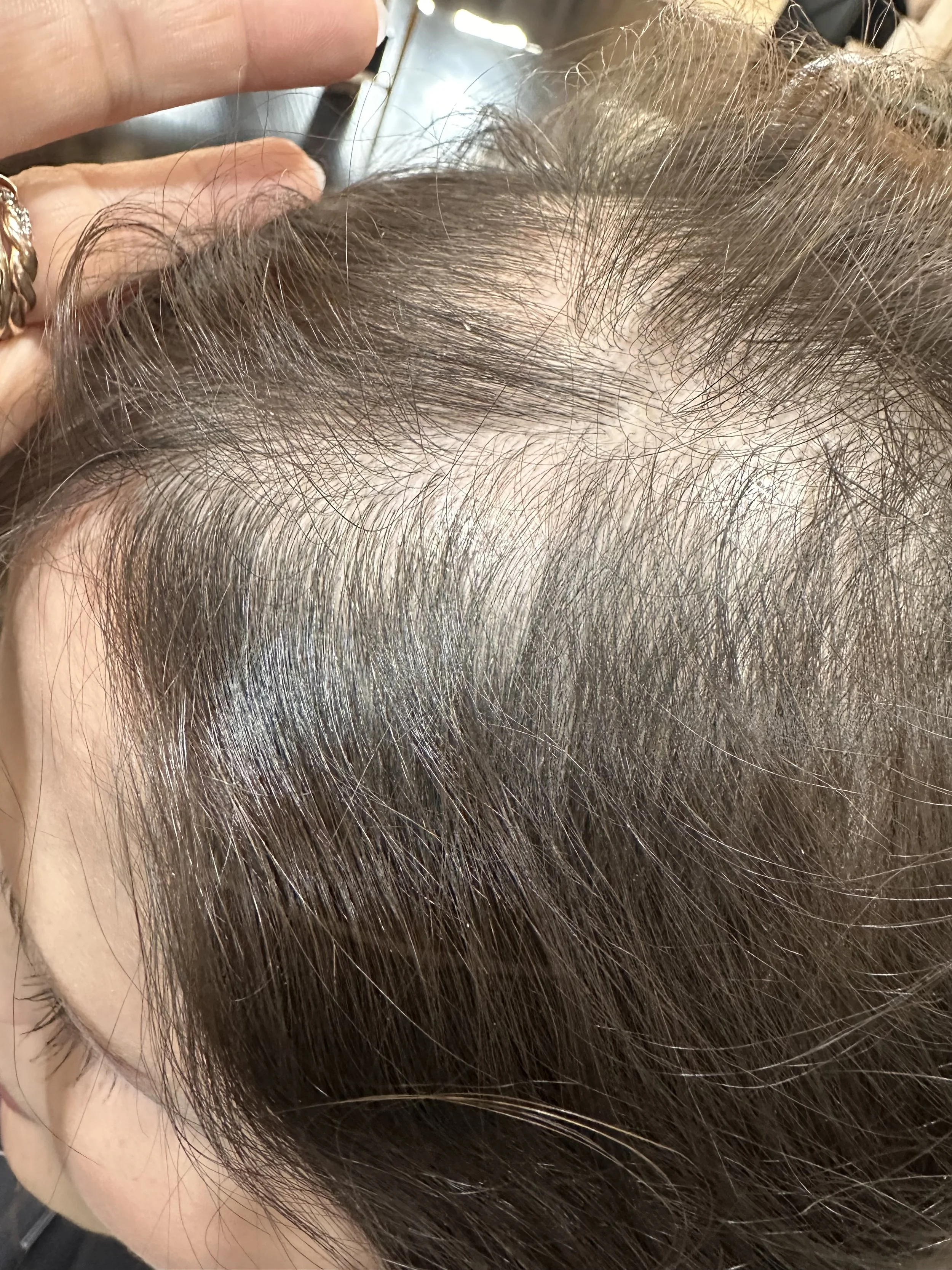 Close-up of dark brown hair parted to reveal the scalp, showing areas of reduced hair density and fine strands near the roots.