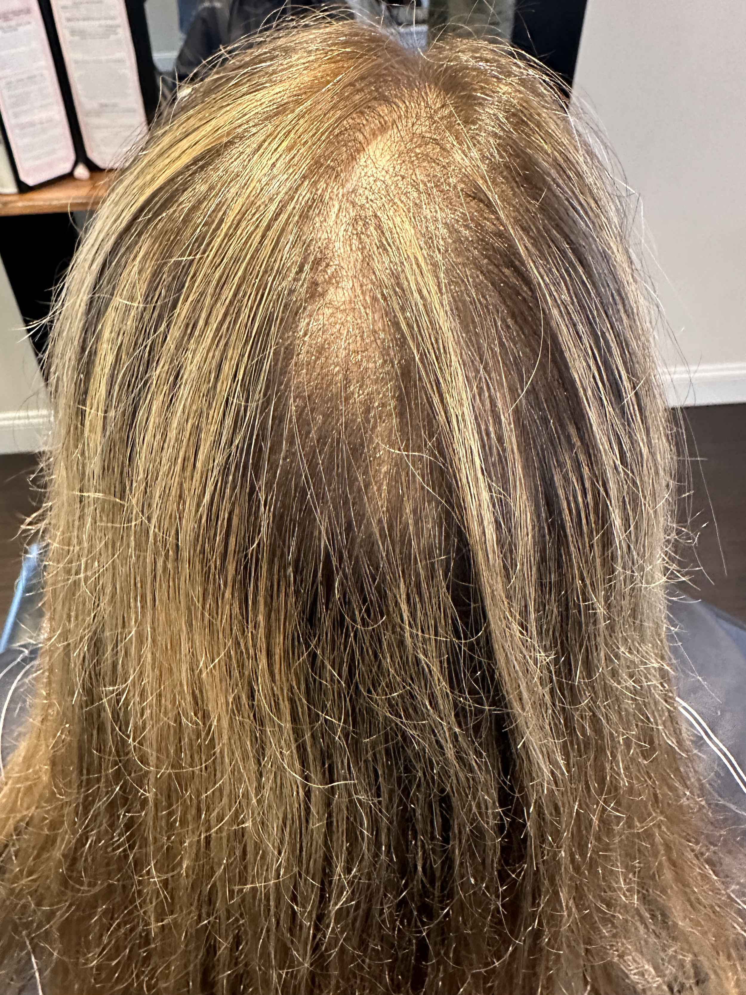 Top view of a woman with fine, light brown and blonde hair showing visible scalp and thinning at the crown before a CombLine hair density enhancement treatment at TEAL Hair & Makeup Studio.