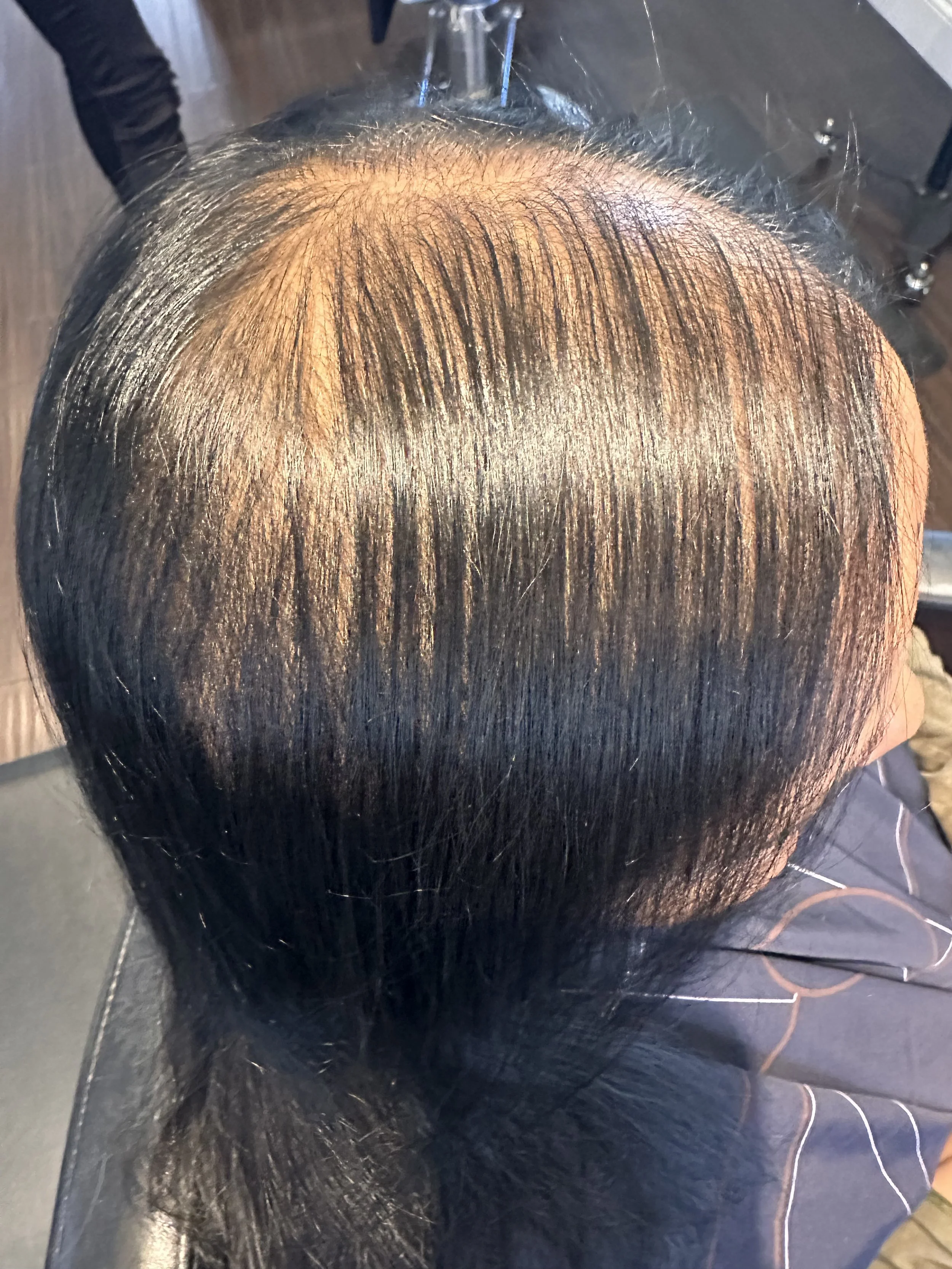 Top view of a woman with dark, straight hair showing significant thinning at the crown and visible scalp, highlighting concerns about hair loss and reduced hair density addressed by TEAL Hair & Makeup Studio.